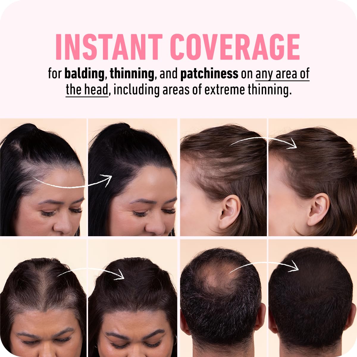 Detalle de Boldify Hairline Powder 10g