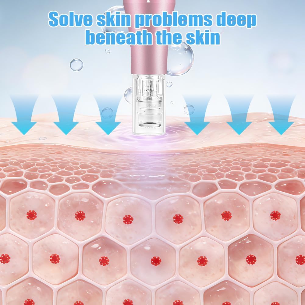 Detalle de Vicloon Round Nano Microneedling Cartridges, 15 Disposable Tips