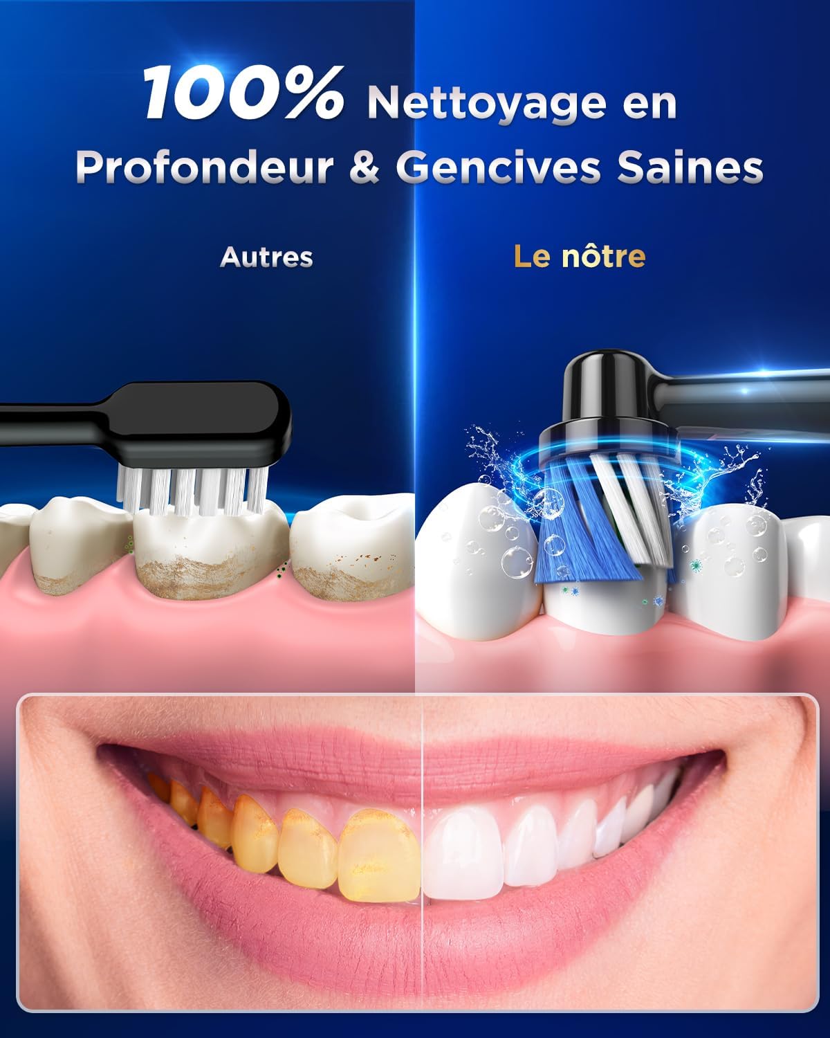 Detalle de YTEATH PRO: Brosse À Dent Électrique Rotative pour Adultes — 5 Modes, 3 Intensités, 8 Têtes, IPX7, Noir Profond