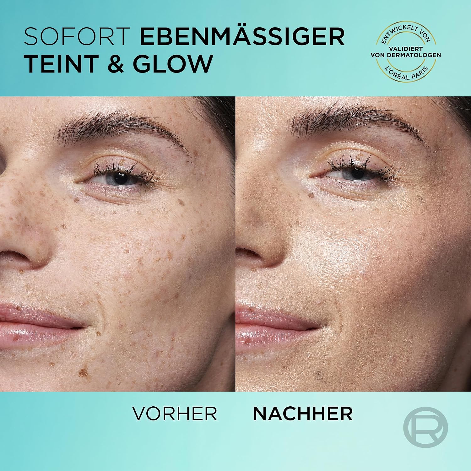 Detalle de L’Oréal Tägliches Getöntes UV Glow-Fluid LSF 50 mit Niacinamid + Glow-Pigmenten, Farbe Hell (Bright Reveal) – 50 ml