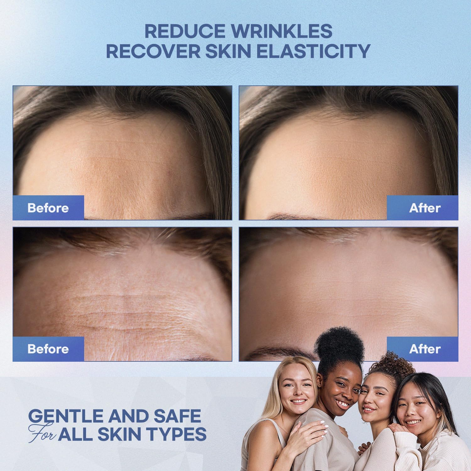 Detalle 1 de SILKDERMIS Forehead Wrinkle Patches, 12-Count with Aloe, Collagen & Vitamin E