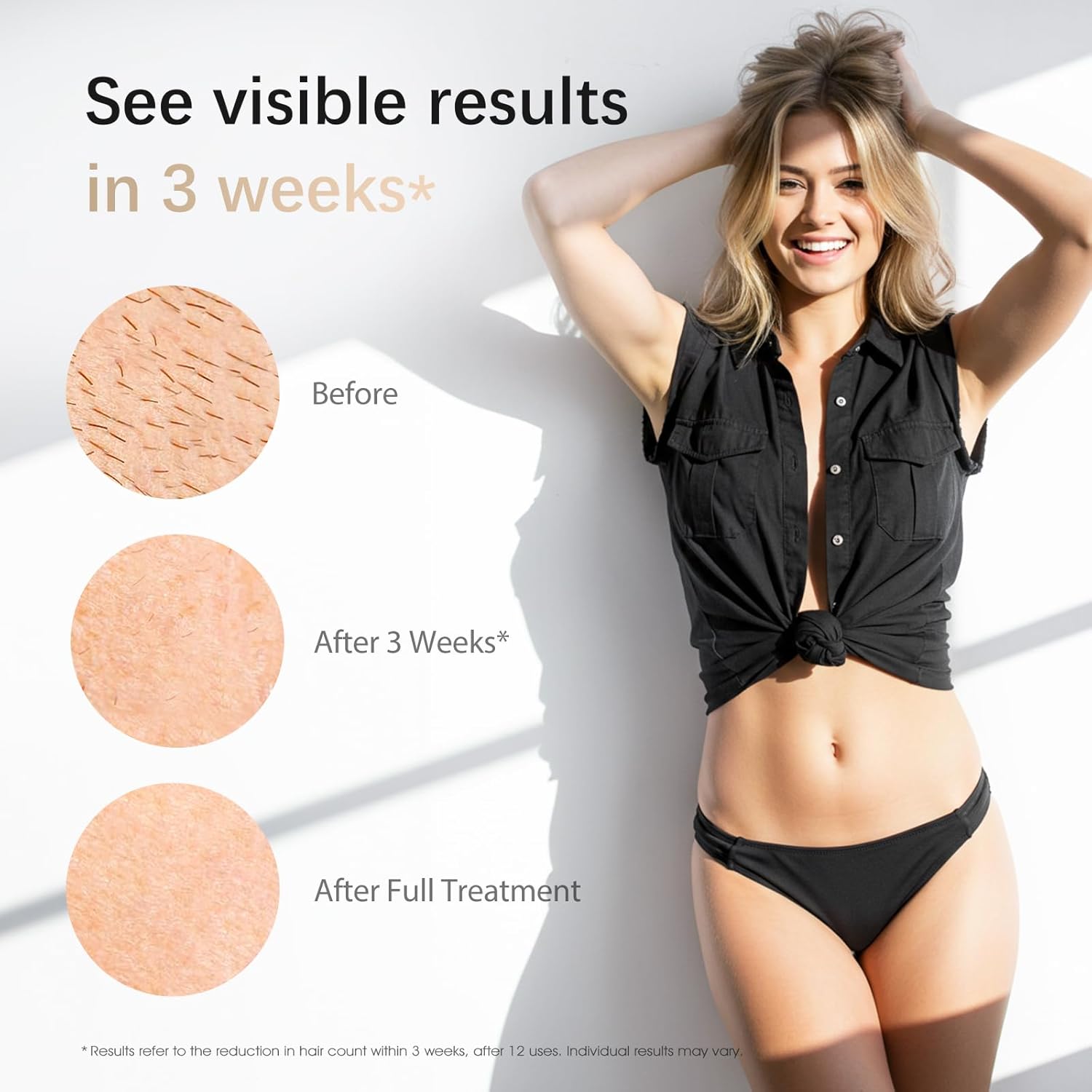 Detalle de IPL Laser Hair Removal Device 86% Results in 3 Weeks