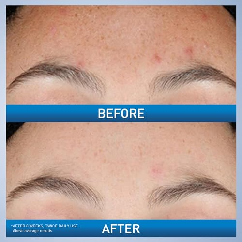 Detalle de CeraVe Resurfacing Retinol Face Serum with Niacinamide, Pore Minimizer, 1oz