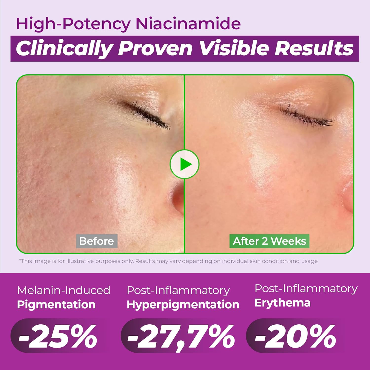 Detalle de JUMISO Niacinamide 20% Serum 40ml