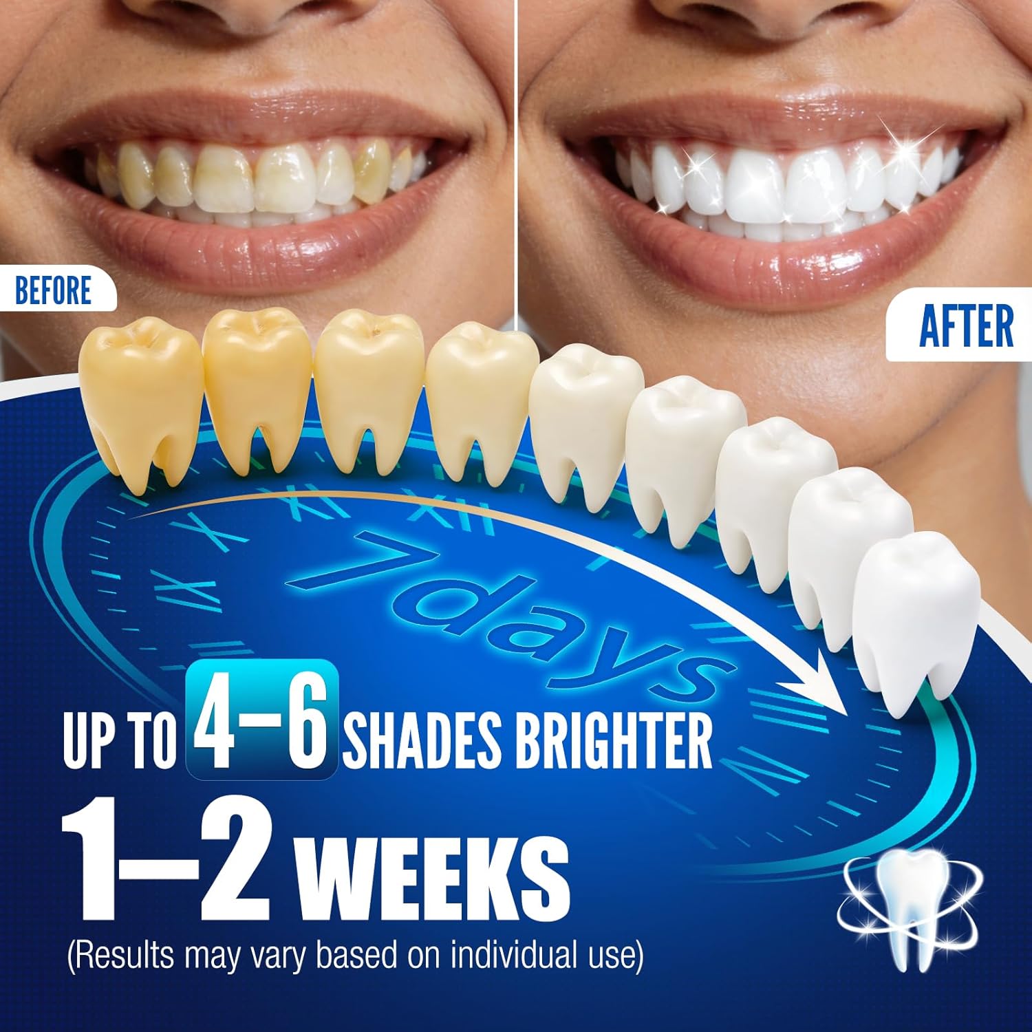 Detalle 2 de Teeth Whitening Pen Kit: 35% Carbamide Peroxide, 6-Pen Set with Remineralizing Pens