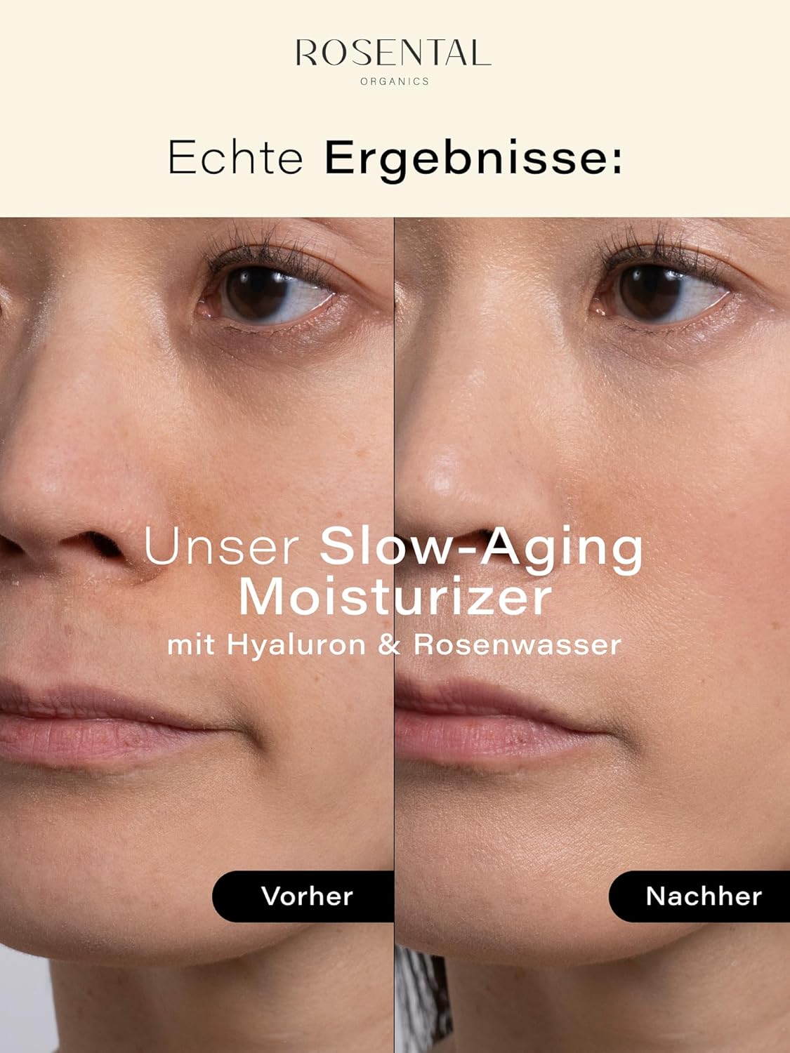 Thumbnail 4 de Rosental Organics Slow Aging Moisturizer (50 ml) – Anti-Aging Feuchtigkeitscreme mit Hyaluronsäure & Rosenwasser