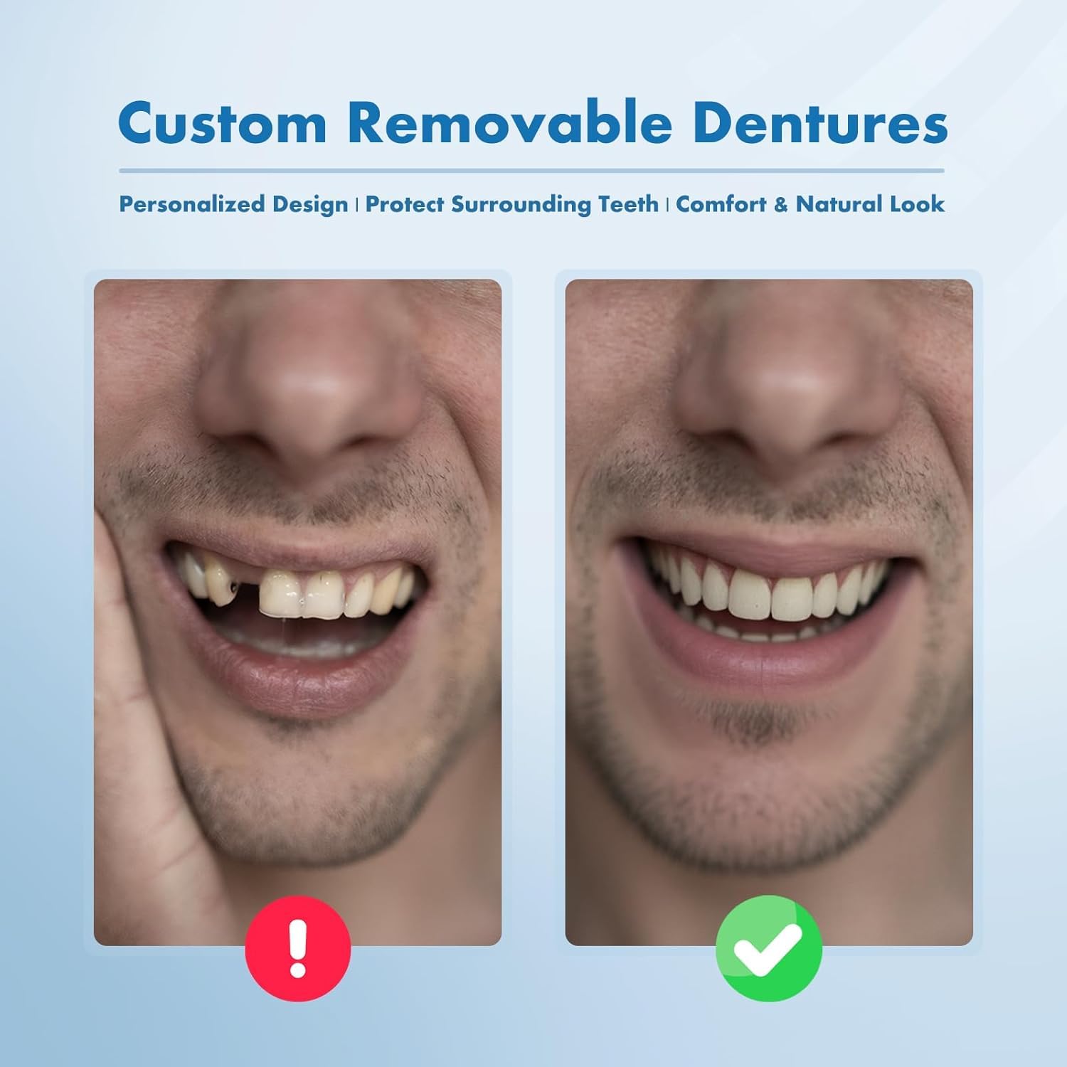 Thumbnail 1 de Custom Removable Dentures Set for Tooth Replacement (2 Teeth) — Personalized Partial Denture with Storage Case