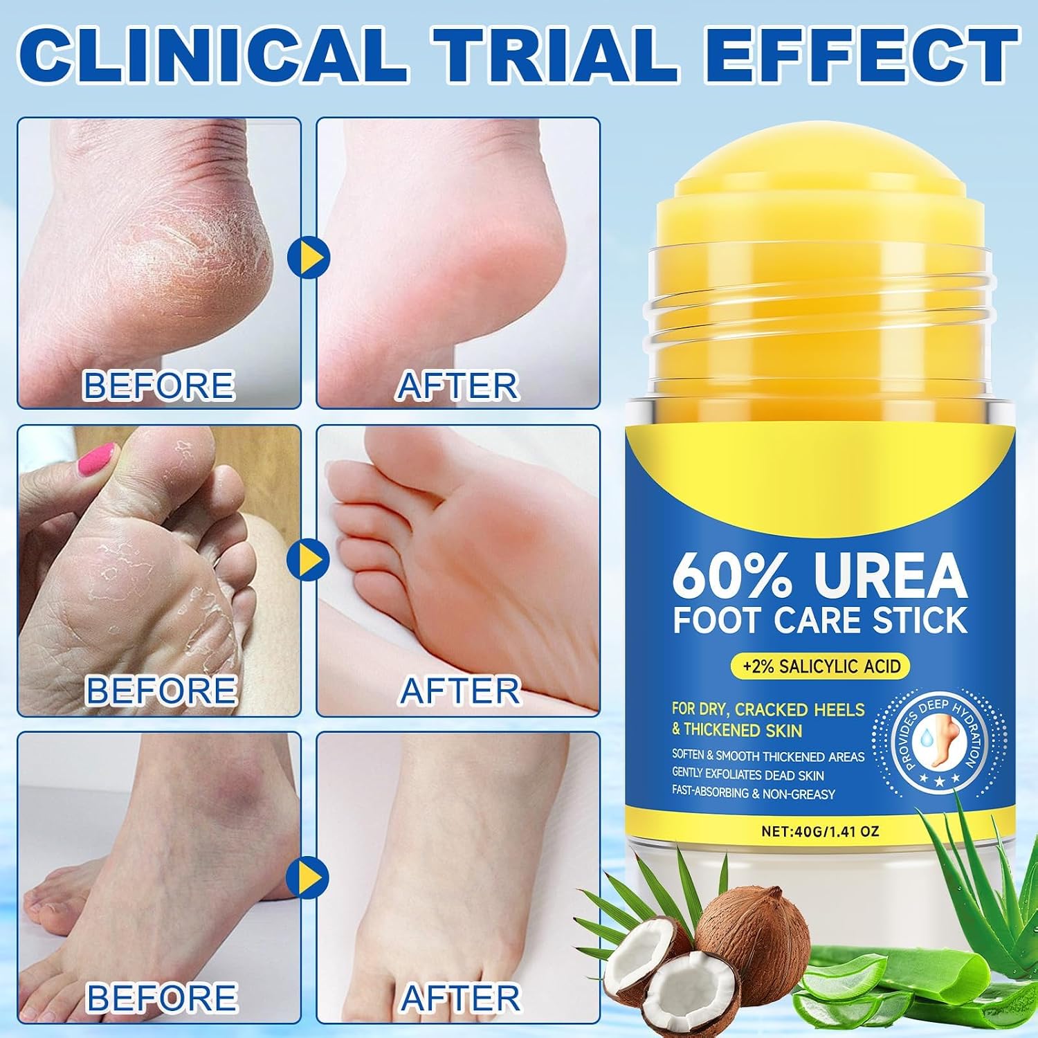 Detalle 2 de Liefiet Urea Foot Cream, 60% Urea