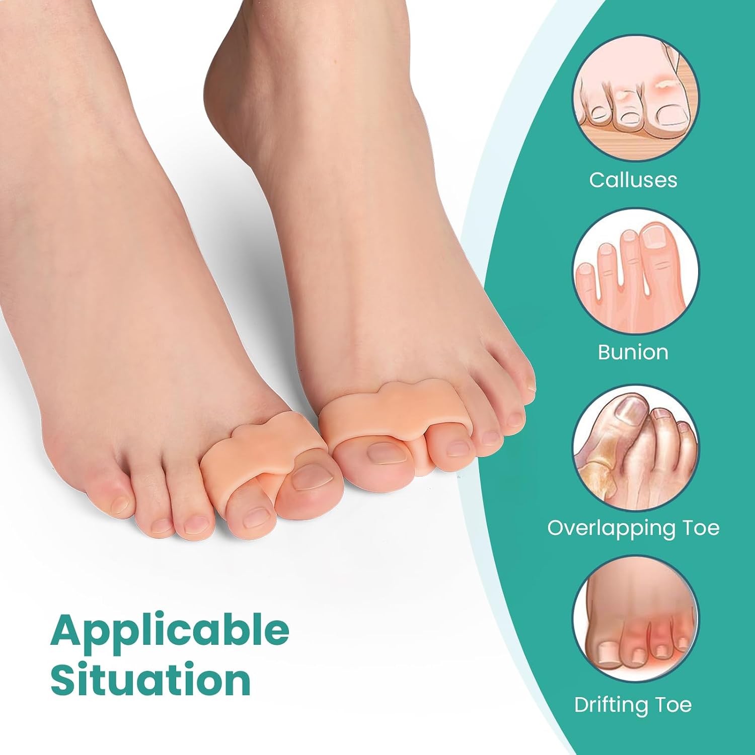 Thumbnail 2 de Welnove Bunion Correctors, 12-Pack Gel Toe Separators with Two Loops, Beige