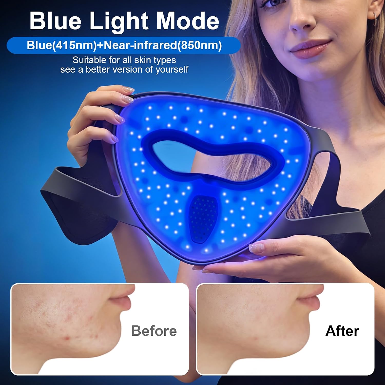 Detalle 2 de YK oliron RLTM-4DMAG-RBV1 Cordless LED Face Mask, Two Light Modes, Grey