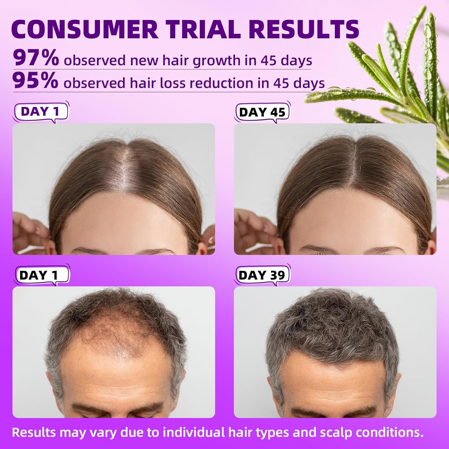 Detalle 2 de Minoxidil 5% Hair Growth Spray