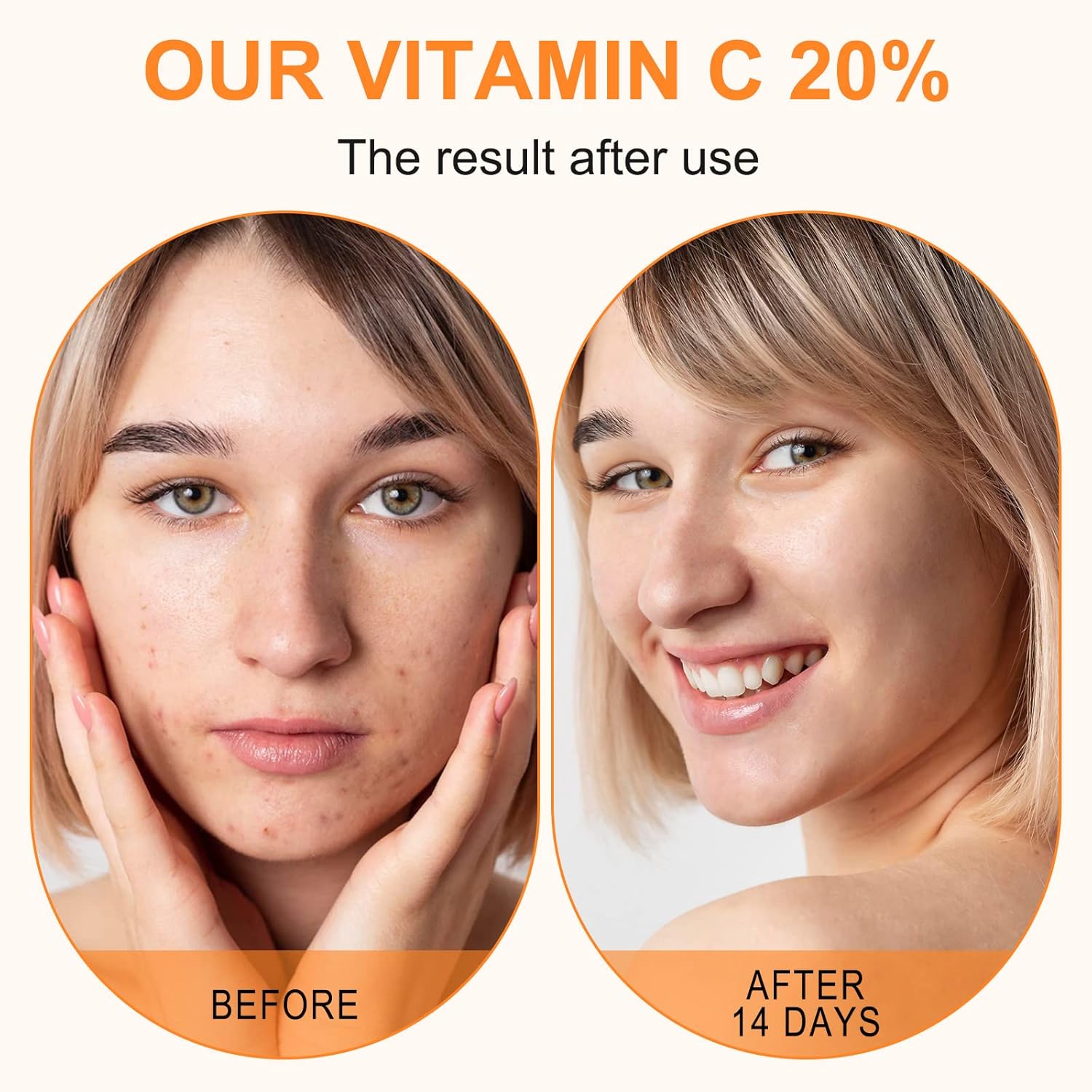 Thumbnail 4 de Premium 20% Vitamin C Serum 60ml