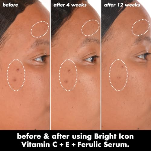Detalle 2 de e.l.f. SKIN Bright Icon Vitamin C + E + Ferulic Face Serum: Brightening, Soothing, and Lightweight