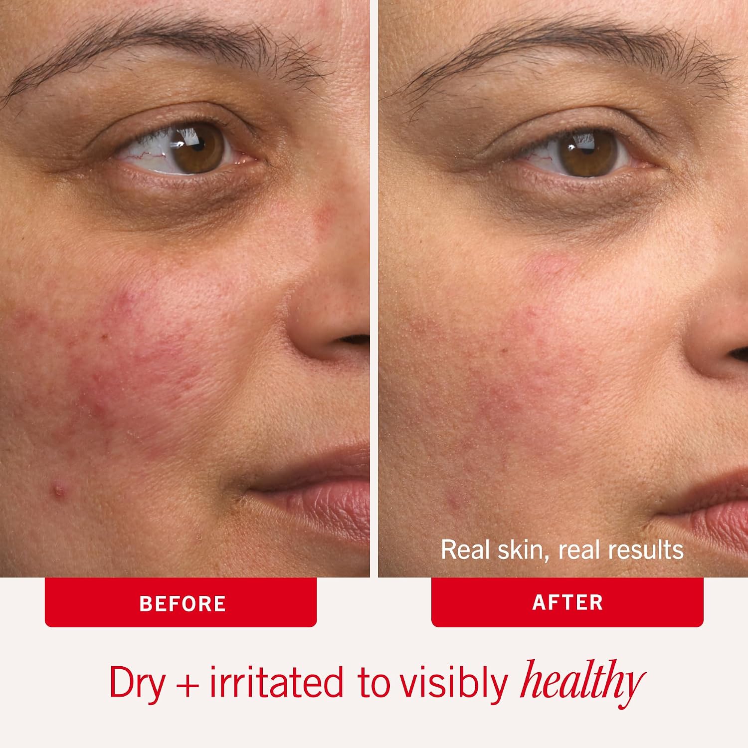 Detalle 1 de First Aid Beauty 40004 Ultra Repair Cream Face & Body Moisturizer with Colloidal Oatmeal