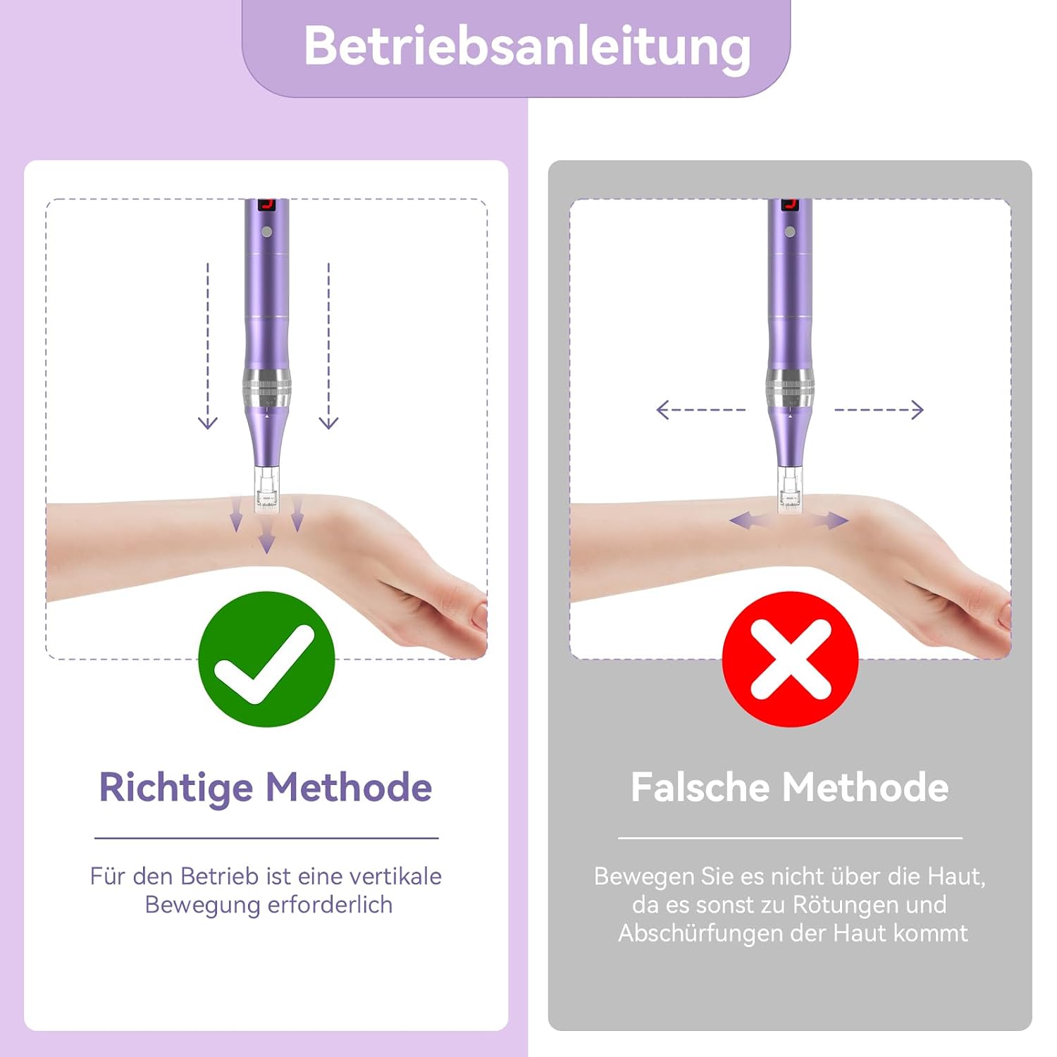 Thumbnail 5 de QUELLE Dermapen E99 Elektrischer Derma-Pen