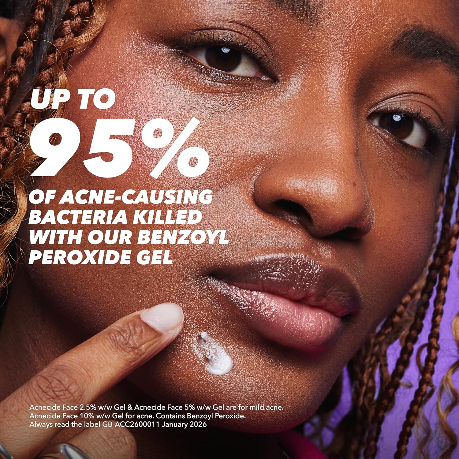 Detalle de Acnecide Face Gel 5% Benzoyl Peroxide 15g – a pragmatic option for mild acne relief