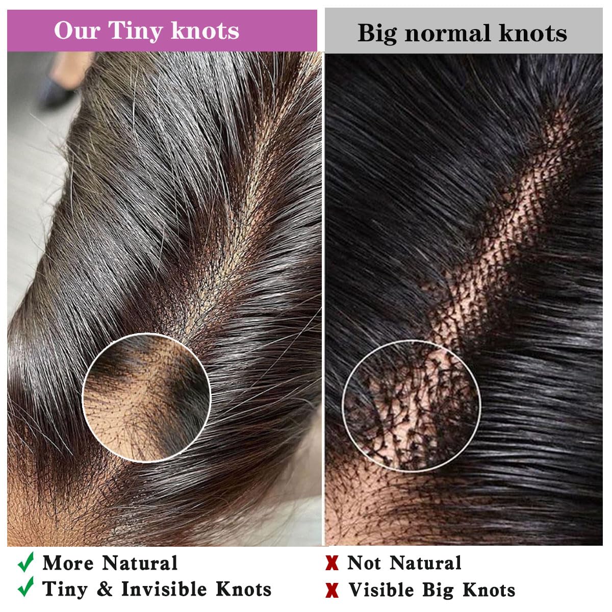 Detalle de Mnador 2x6 SKINLIKE HD Lace Closure (Deep Parting, Straight, 16in) Brazilian Virgin Human Hair