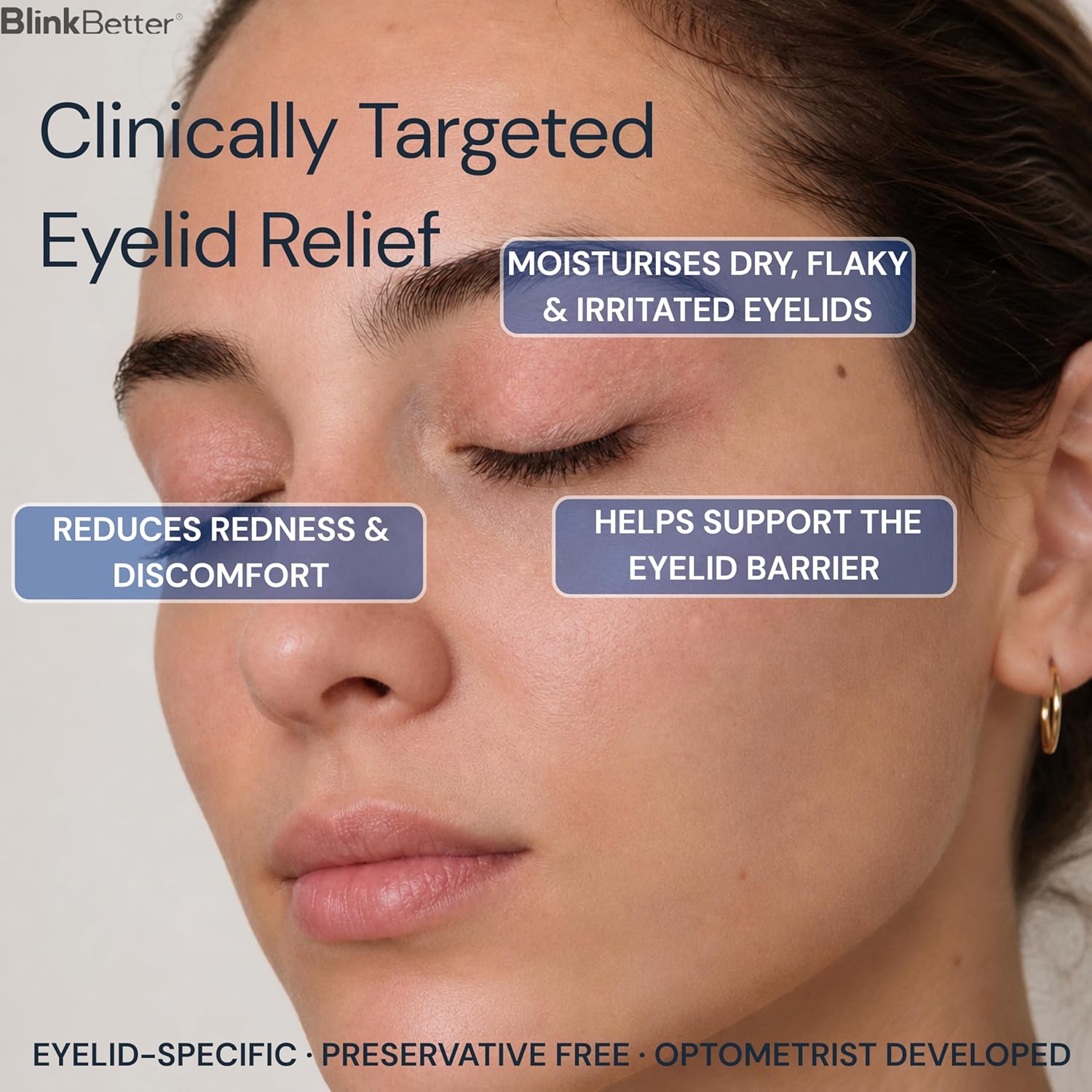 Thumbnail 4 de BlinkBetter BetterLids Eyelid Ointment 0.34 oz