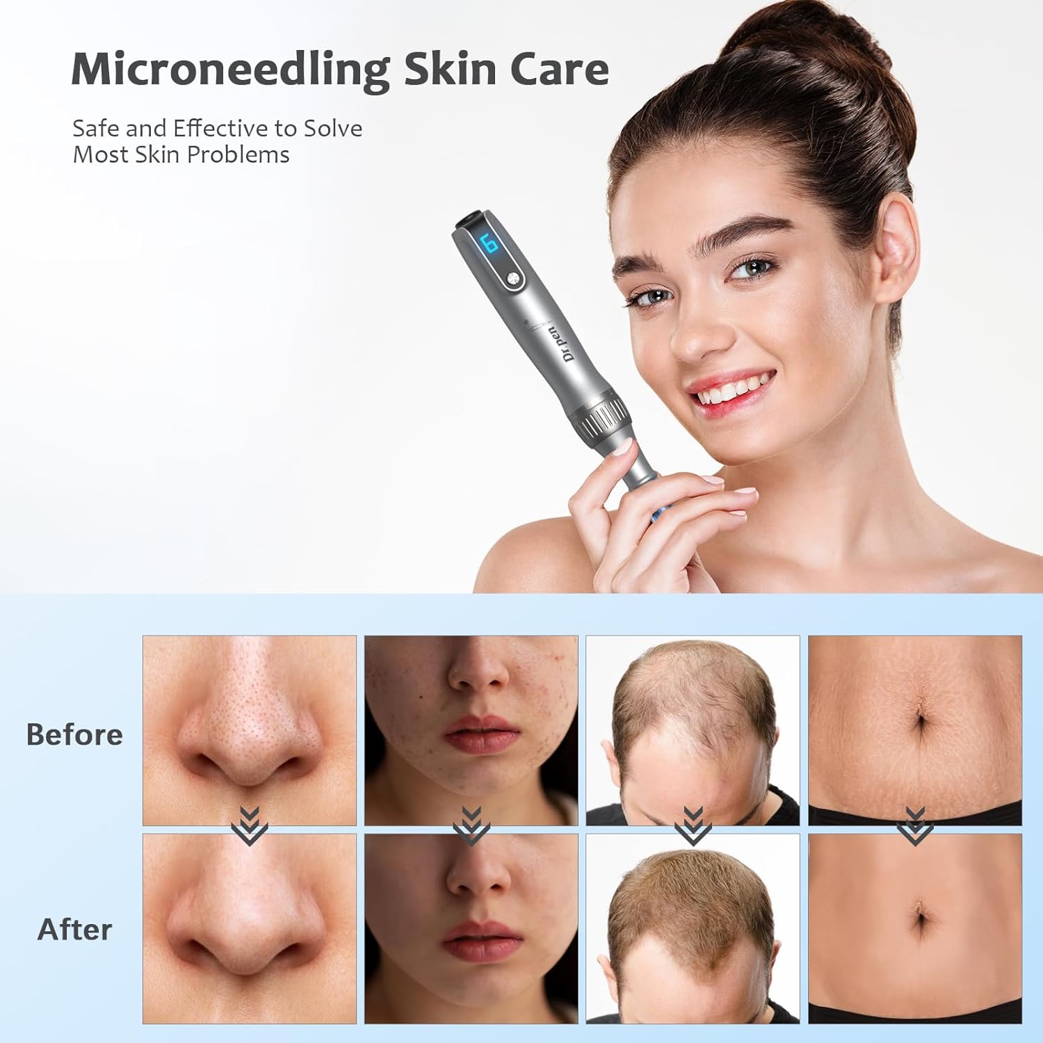 Thumbnail 6 de Dr. Pen M8S Microneedling Pen 8 cartouches
