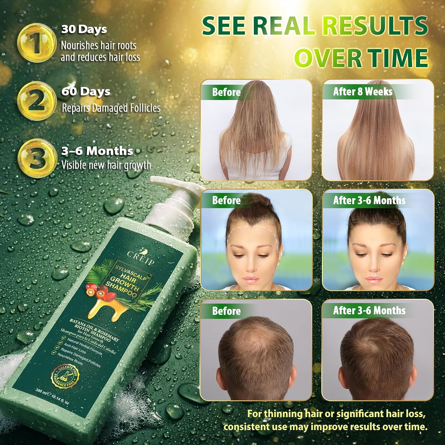 Detalle 1 de Rosemary & Batana Oil Hair Growth Shampoo, Sulfate-Free