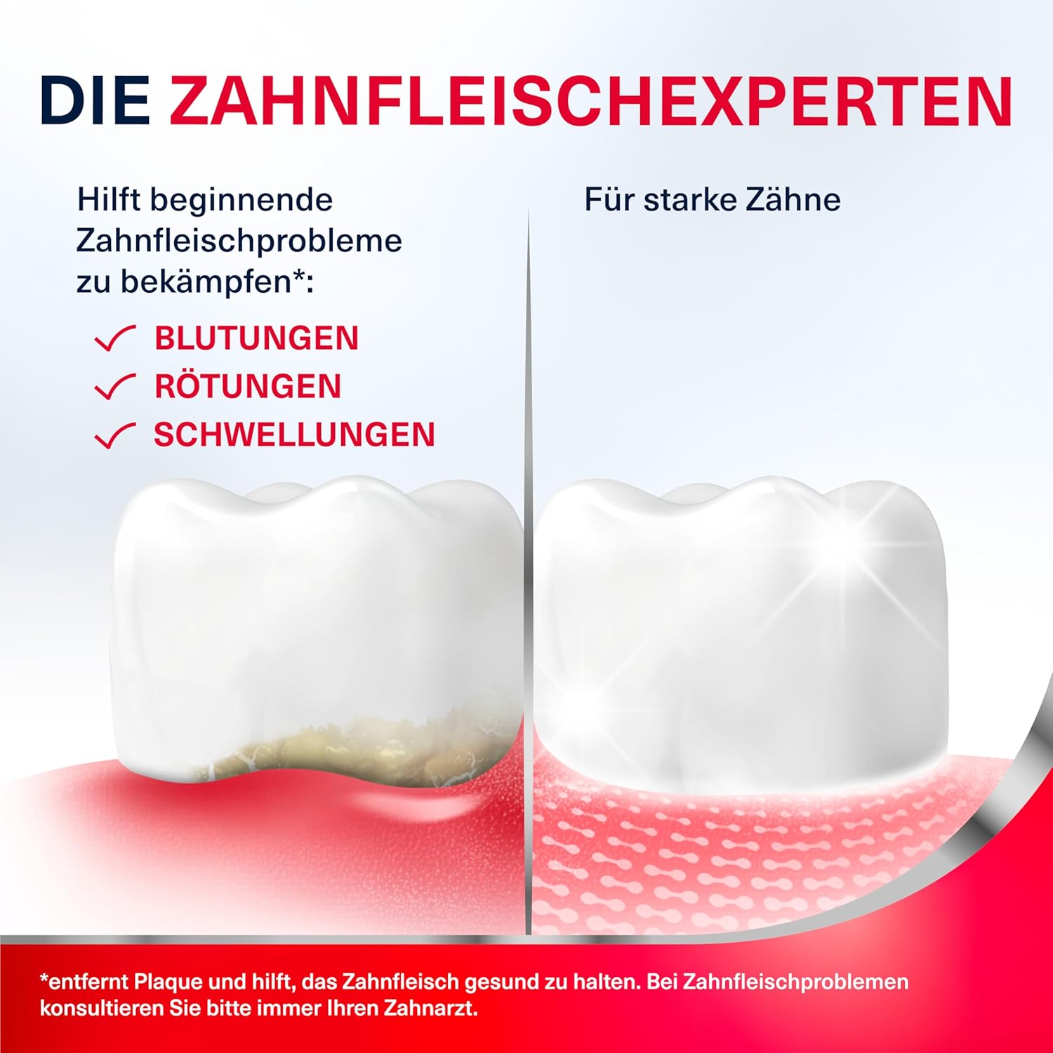 Thumbnail 2 de Parodontax Original Zahnpasta 4x75 ml – gegen Zahnfleischbluten