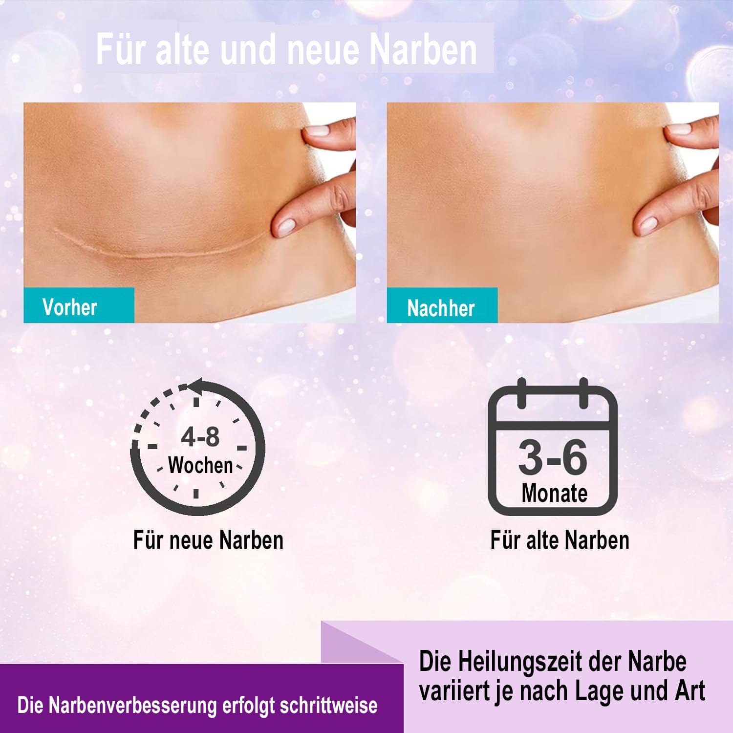 Detalle de 1.5M Fogli di silicone cicatrici – fornitura di 6 mesi, riutilizzabili e delicati sulla pelle