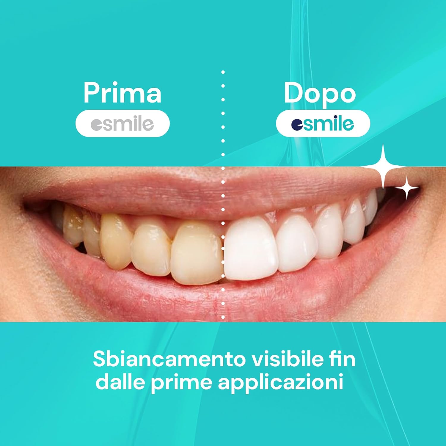 Thumbnail 4 de ESMILE Polvere Sbiancante Denti 30g