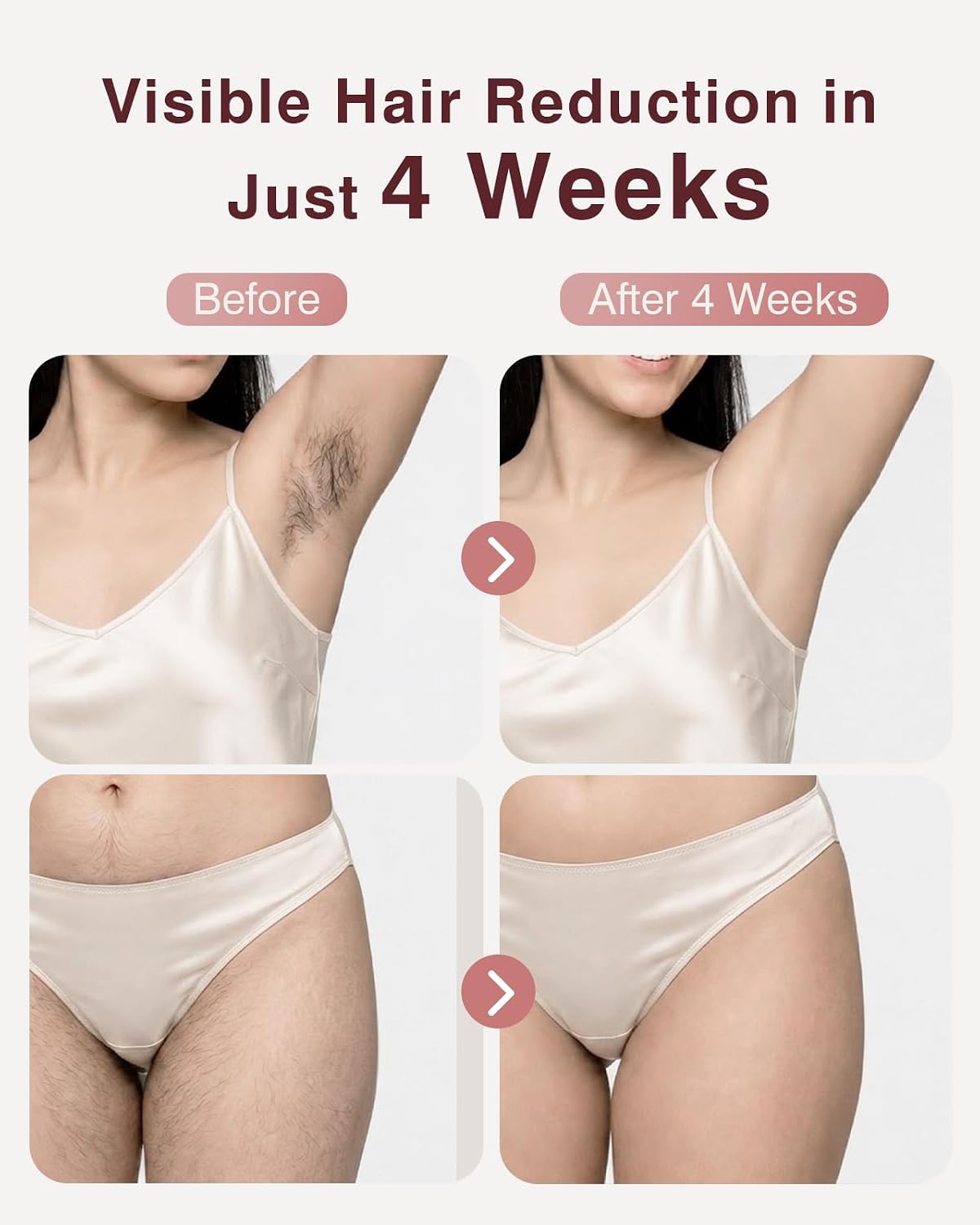 Detalle de TIIMAGIC IPL Laser Hair Removal Device for Women and Men - Ice Cooling, 9 Levels, 999,900 Flashes, At-Home Use