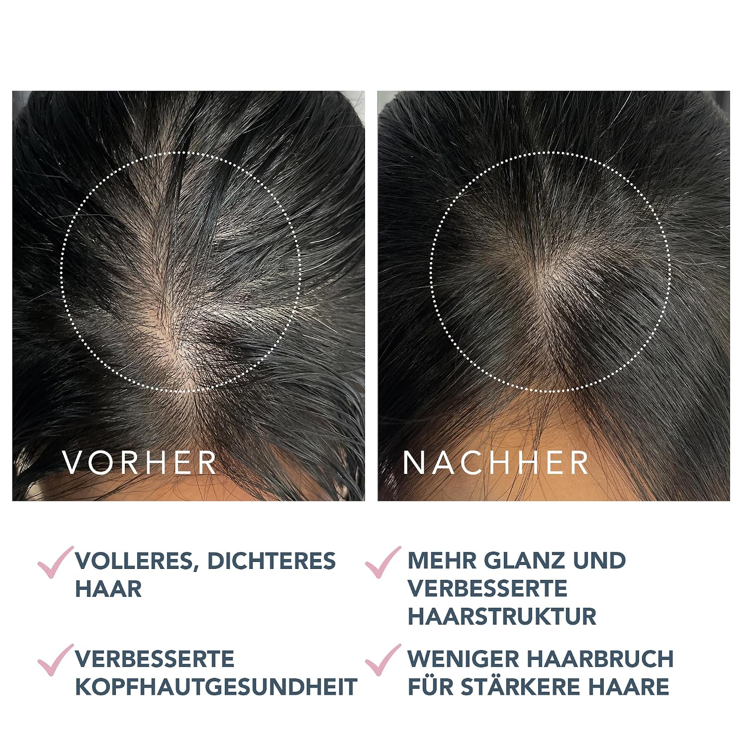 Detalle de FOREO LUNA Dual-Peptid-Kopfhautserum (60 ml) – Haarwachstumsserum mit Peptidkomplex, Cica & Portulak