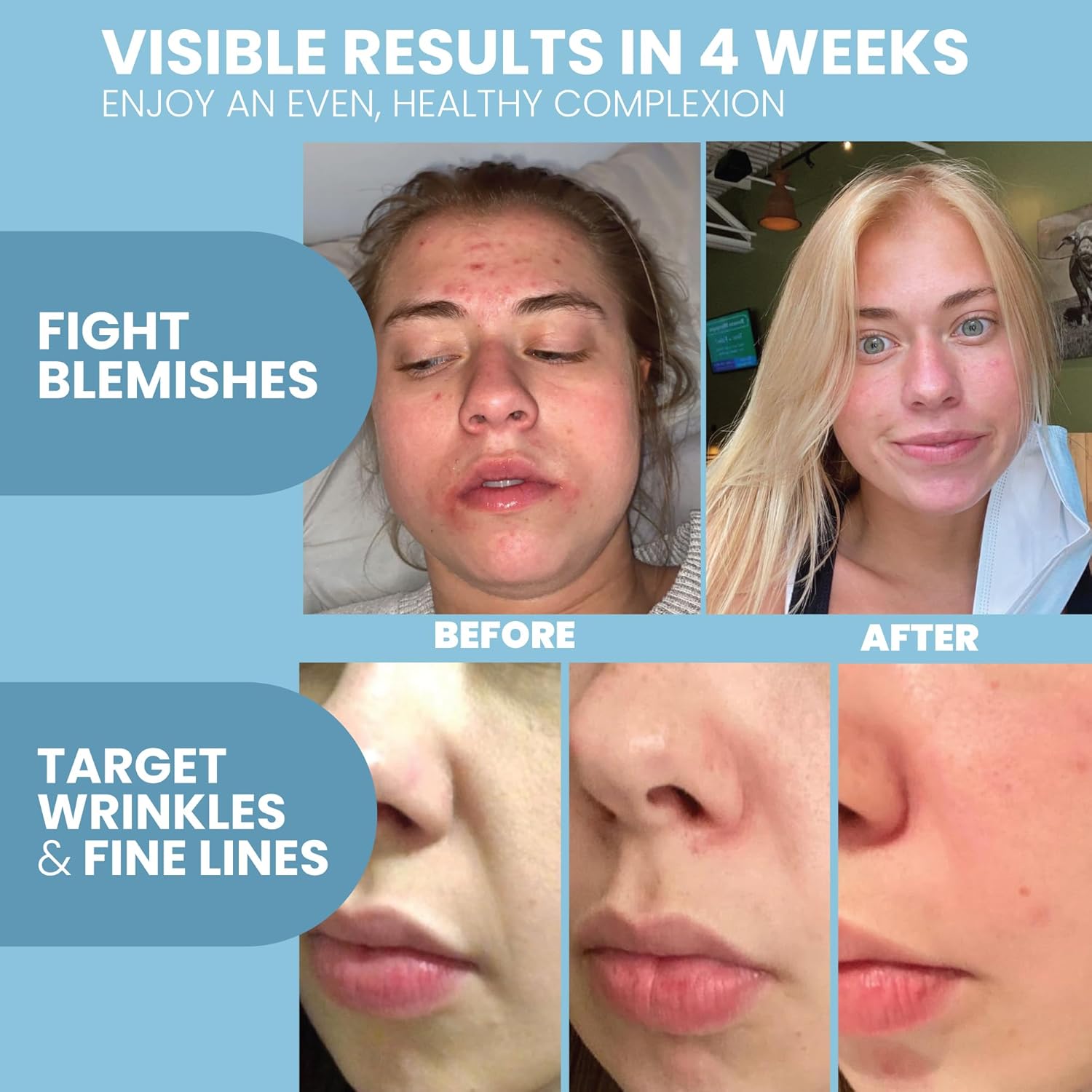 Detalle de Retinol Serum for Face with Hyaluronic Acid – Lightweight Night Serum for Smoother, Radiant-Looking Skin
