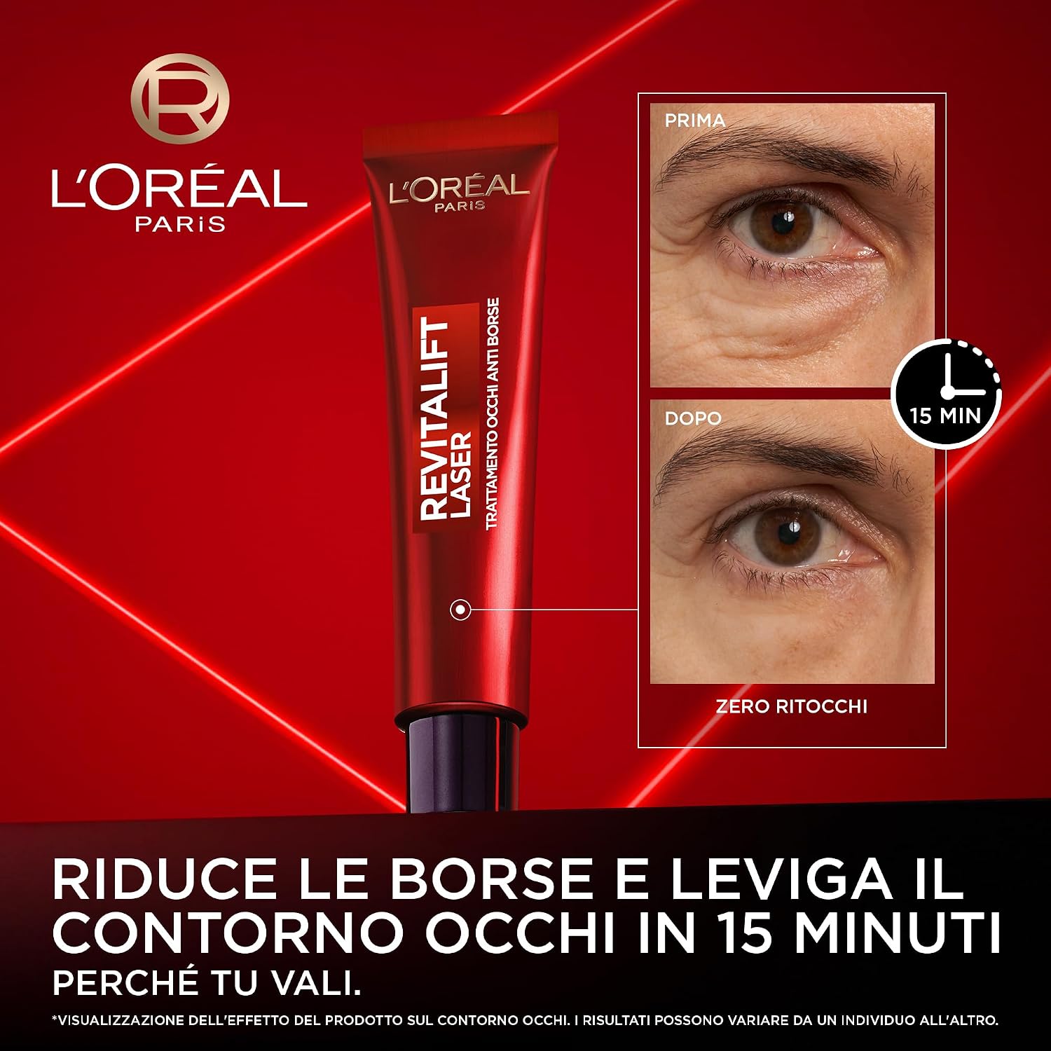 Detalle 2 de L'Oréal Paris Contorno Occhi 15 ml 💄