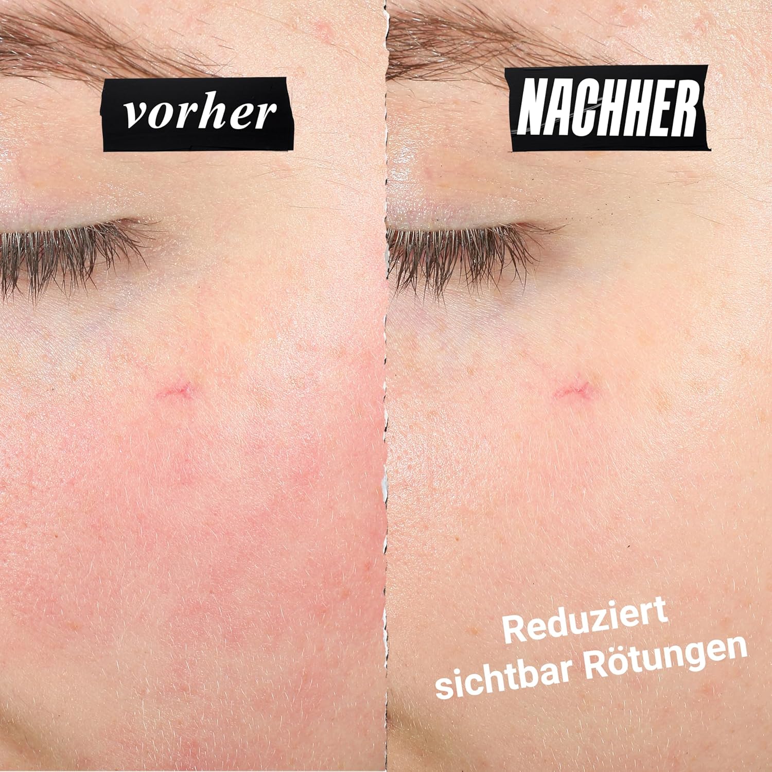 Thumbnail 5 de Kiehl’s Ultra Facial Meltdown Recovery Cream (50 ml) – Gesichtscreme für empfindliche, zu Ekzemen neigende Haut