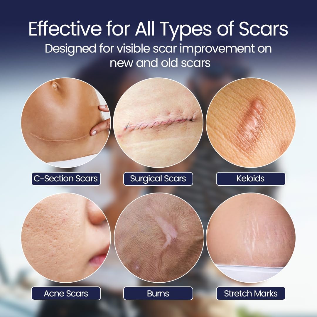 Thumbnail 6 de ScarFix+ Silicone Scar Tape: 18 pre-cut transparent plasters in 3 sizes