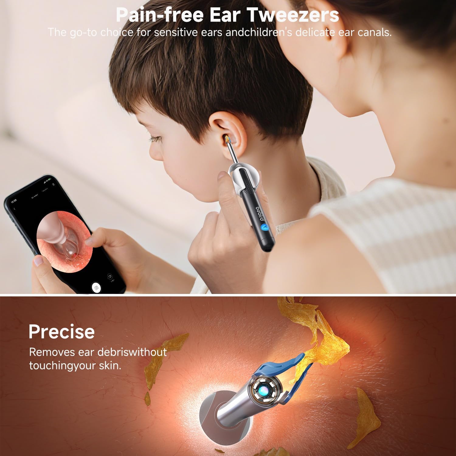 Thumbnail 3 de BEBIRD R1 Ultra Ear Wax Removal Kit with Camera Otoscope – UK assessment