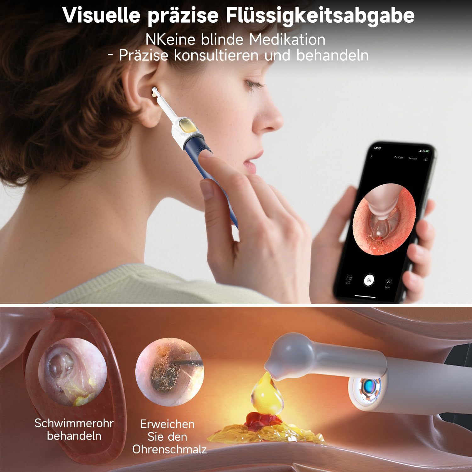 Detalle 2 de BEBIRD R1 Ultra Ohrenschmalz Entferner mit Otoskop-Kamera – Komplett-Set für Zuhause