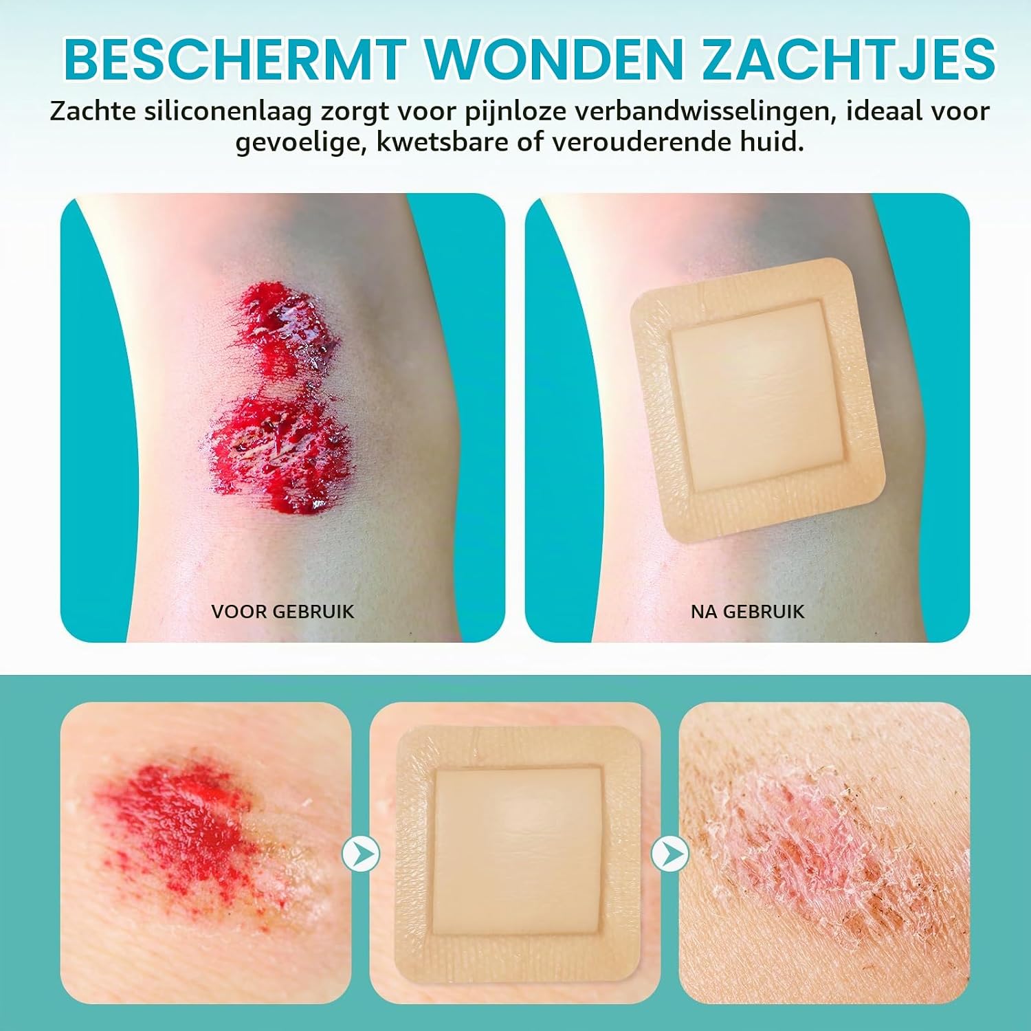 Thumbnail 3 de LEISGOTO siliconen schuimverband 10 x 10 cm, steriel en absorberend