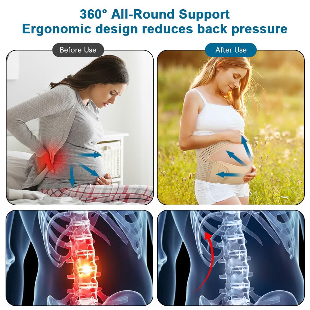 Thumbnail 4 de AUYAO Ceinture de Grossesse – Ceinture ventrale respirante XL, soutien abdominal et lombaire