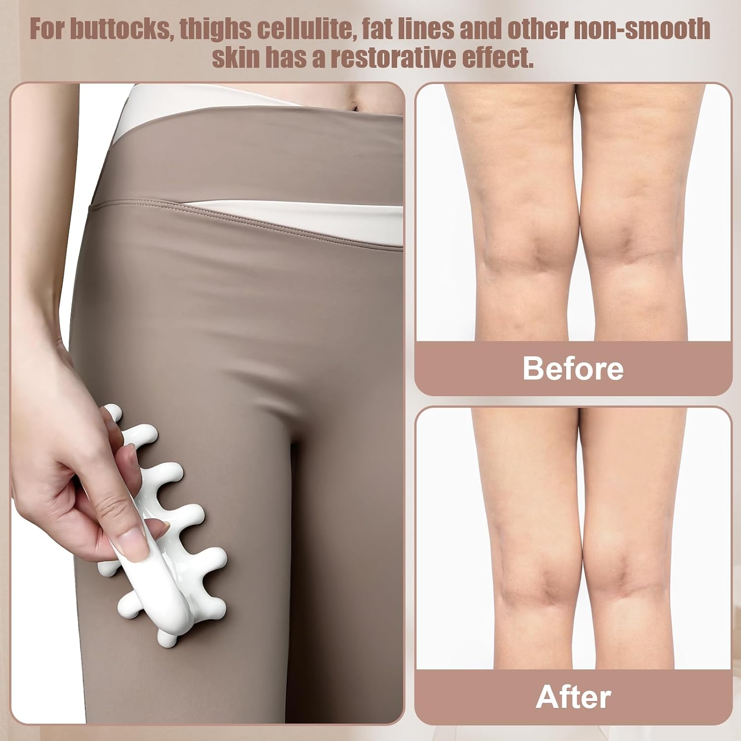 Thumbnail 4 de VEMOKY ccb44152-cfb0-4dce-87c3-f33e6e80a8dd Fascia Massage Tool, Manual, 21 Contacts