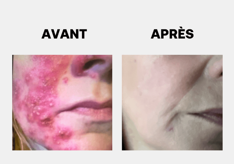 Thumbnail 1 de Rexaline Labs Derma Repair Creme Reparadora Antirojeces 50 ml