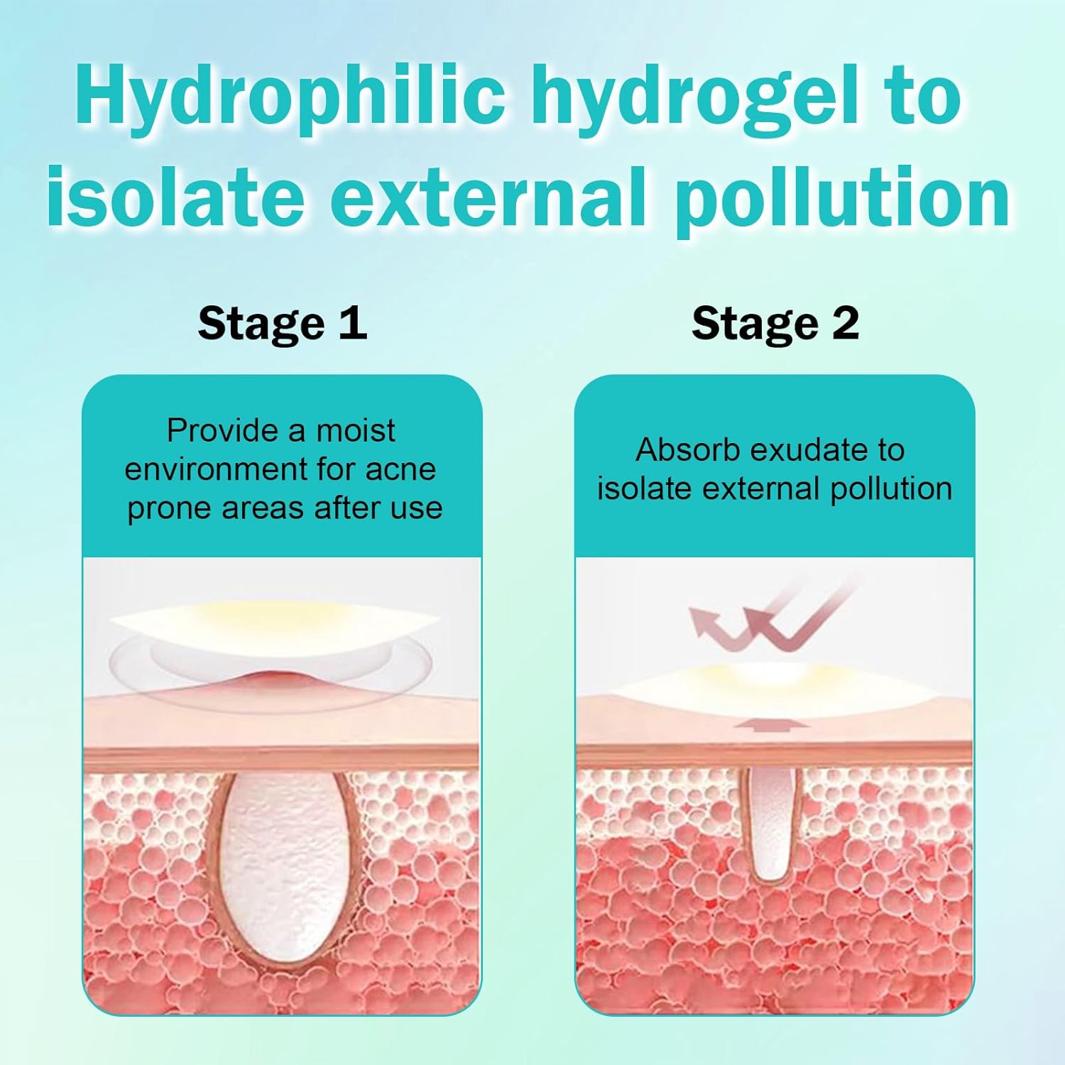 Thumbnail 1 de Pimple Patches Pickel Patch mit Teebaumöl & Salicylsäure – Anti-Pickel Pflaster (528 Stück)