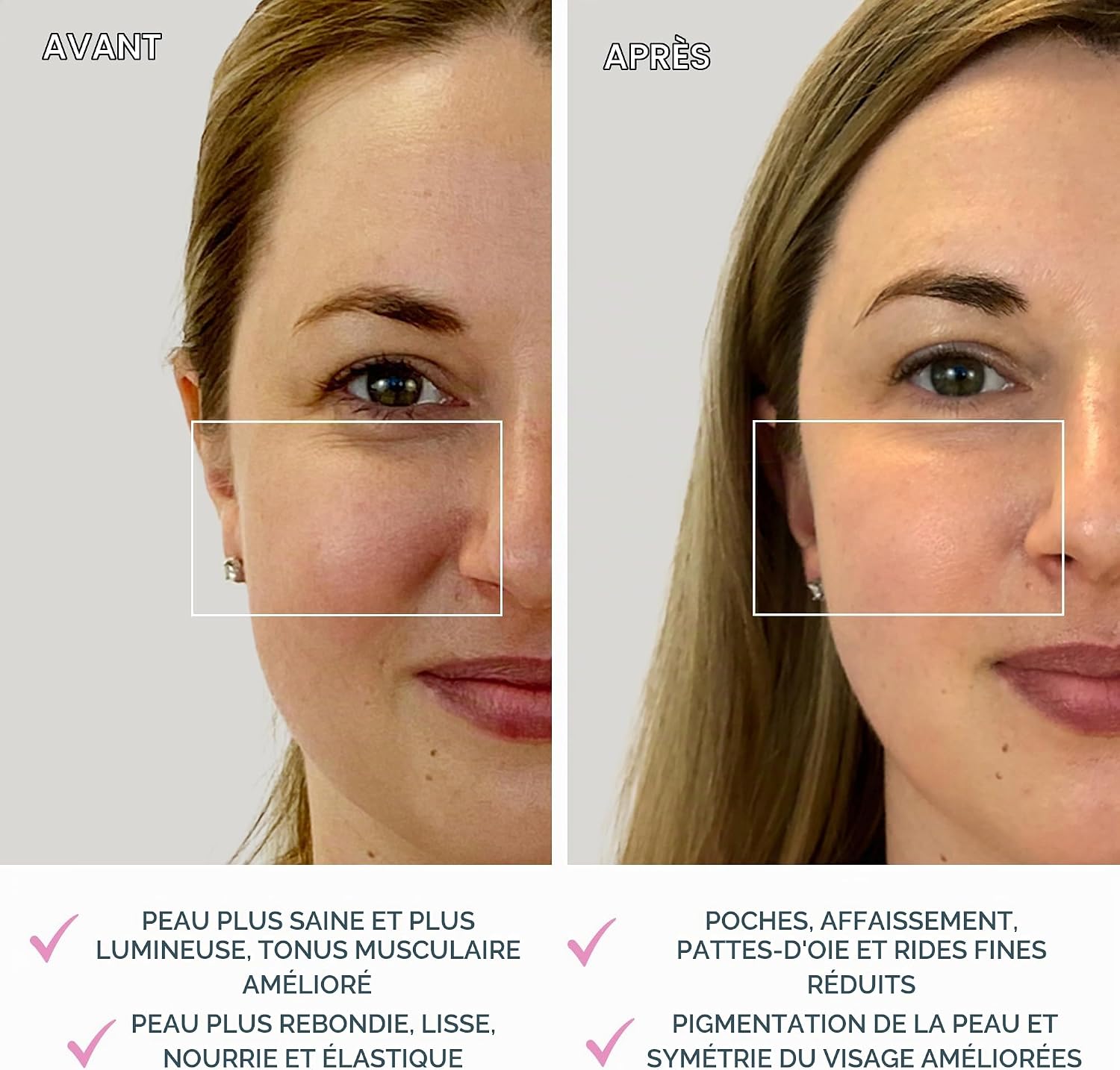 Detalle de FOREO BEAR mini : appareil de lifting ciblé par micro-courants, visage non invasif