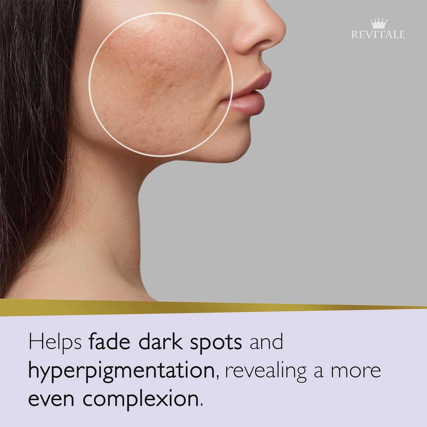 Thumbnail 2 de REVITALE Revitale Savon Avancé à l’Acide Azélaïque et à la Niacinamide – barre nettoyante apaisante