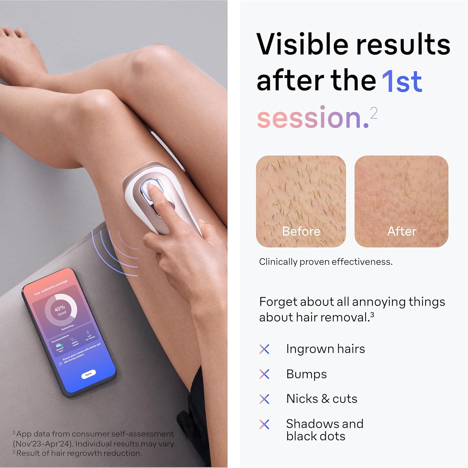 Detalle 2 de Braun Smart IPL Skin i·Expert Pro 7 3 Heads