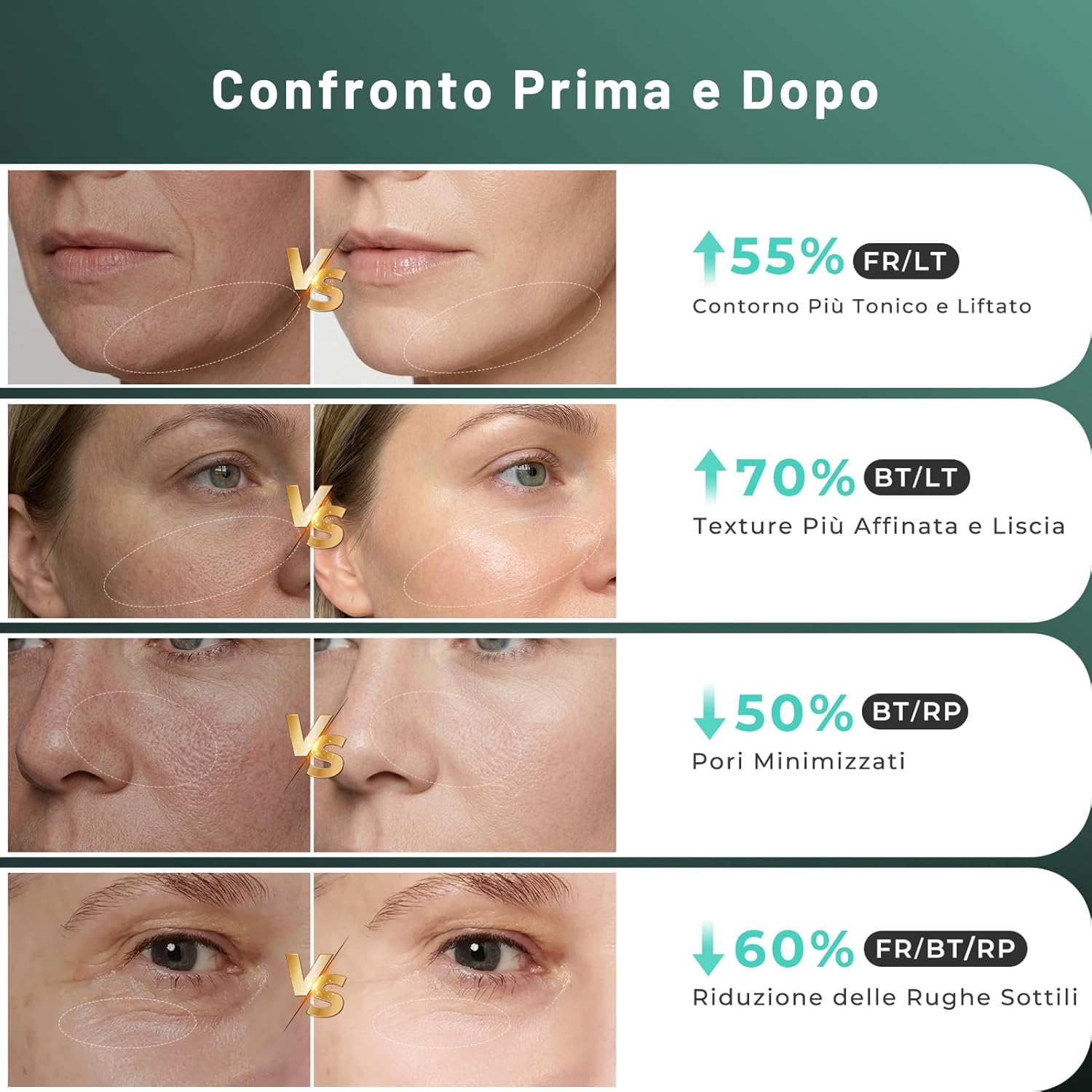 Detalle de Radiofrequenza Viso Professionale con Microcorrente e LED – Massaggiatore Viso e Collo (verde)