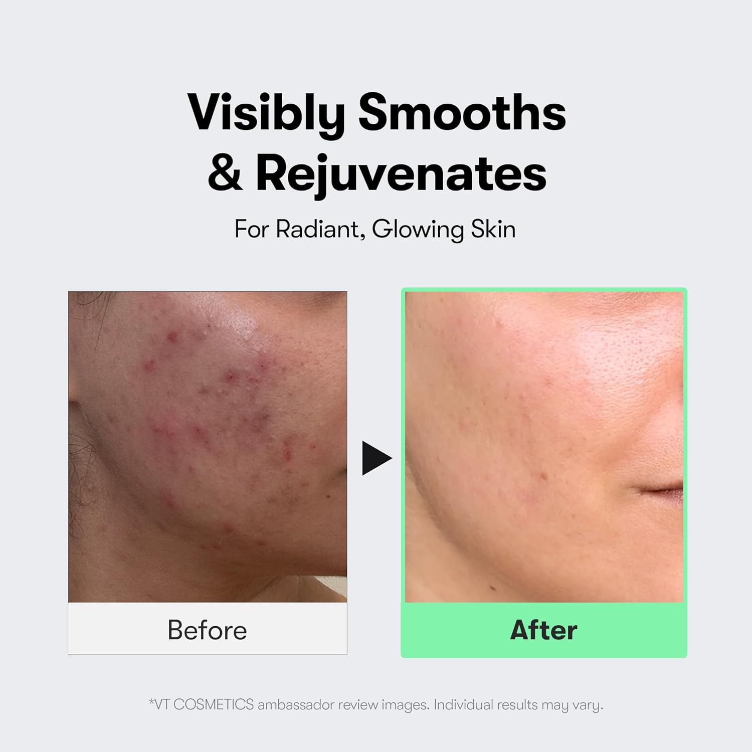 Detalle de VT COSMETICS CICA Reedle Shot 100 spicule microneedling serum (50ml) for pore care & texture