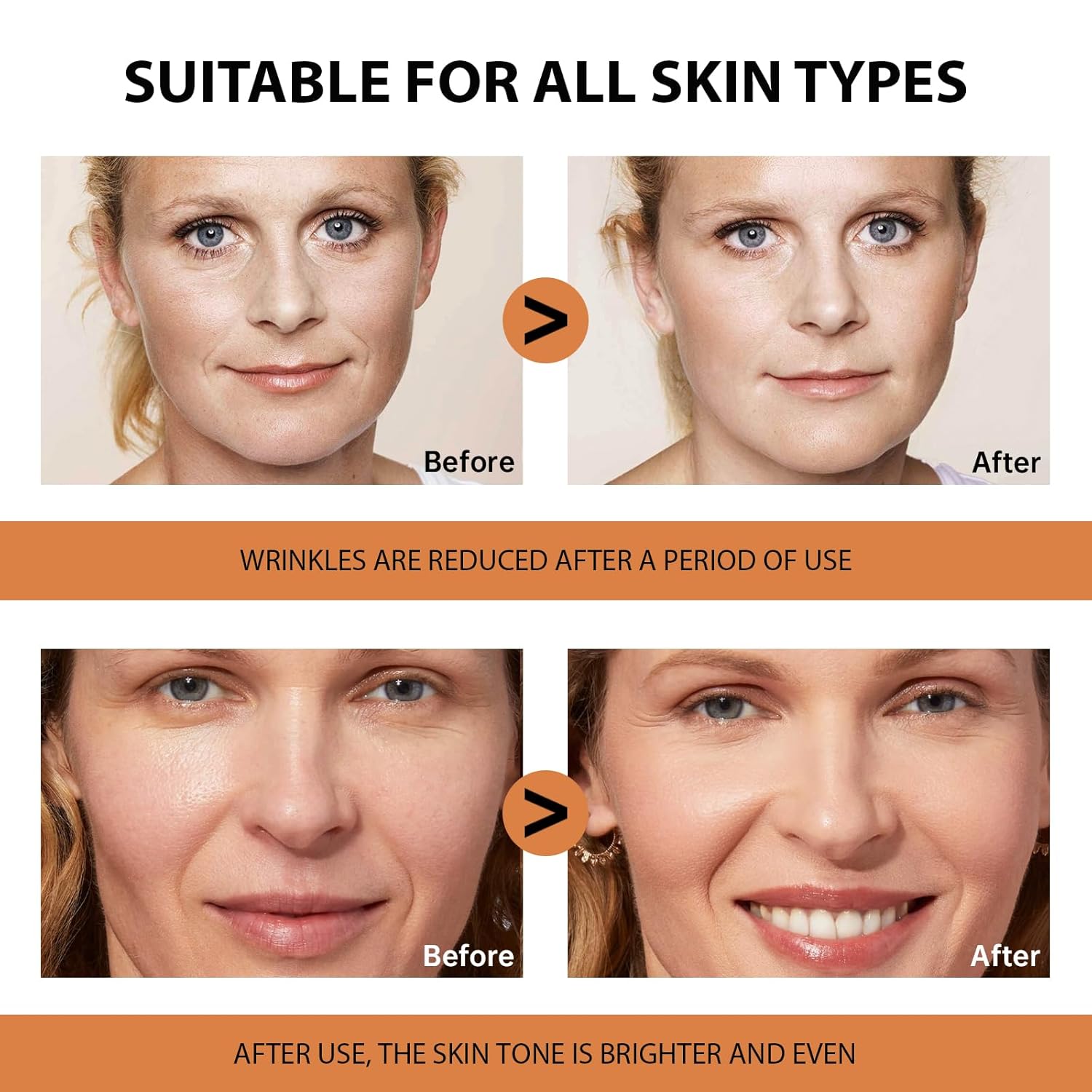 Detalle de VGO Vitamin C Serum for Face (Hyaluronic Acid + Vitamin E) — Anti-Aging Hydration for All Skin Types