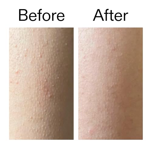 Thumbnail 6 de The INKEY List Glycolic Acid Exfoliating Body Stick 45g