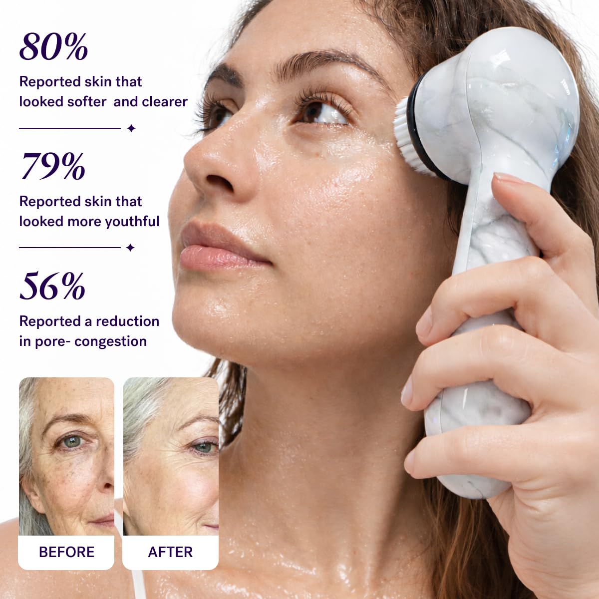Thumbnail 4 de Michael Todd Beauty Soniclear Allure 2024 Facial Cleansing + Exfoliation Brush System