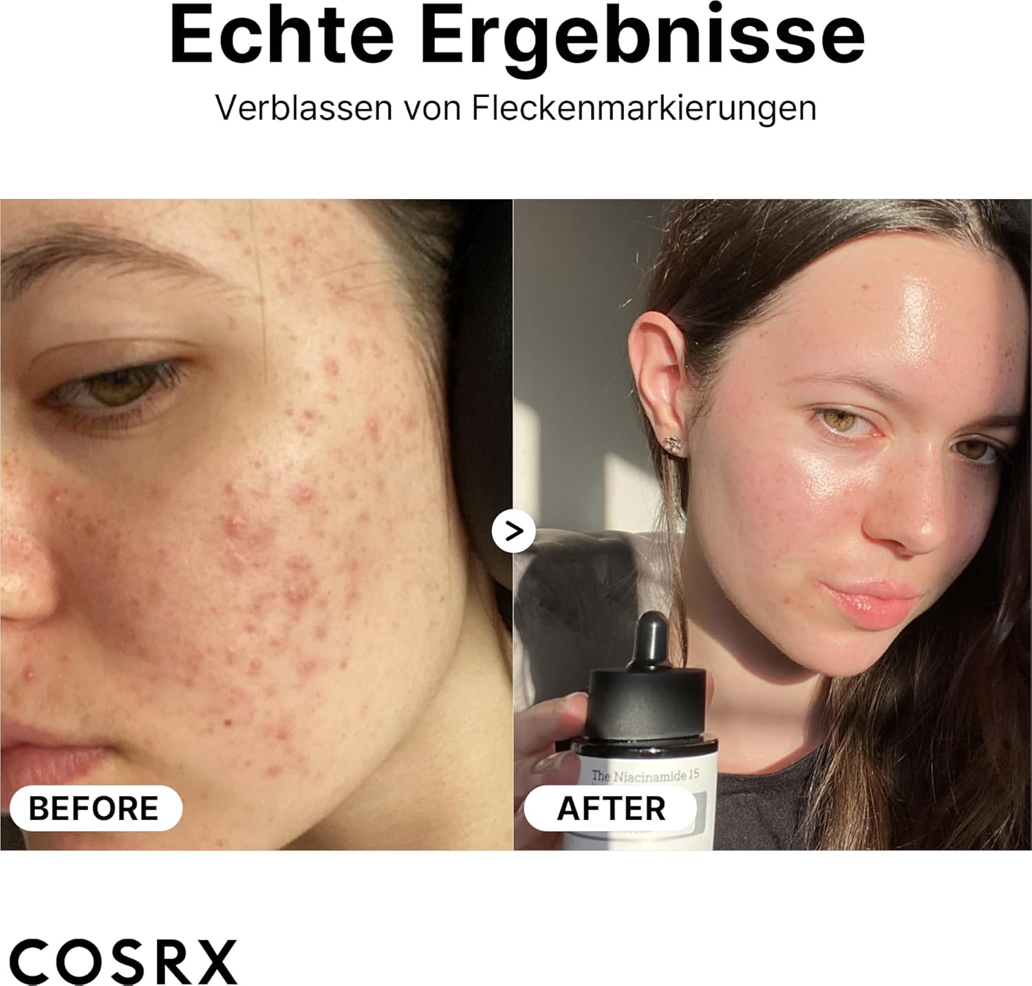 Detalle 2 de COSRX Niacinamide 15% Gesichtsserum – Verkleinert Poren, beruhigt Rötungen & korrigiert Verfärbungen (20 ml)