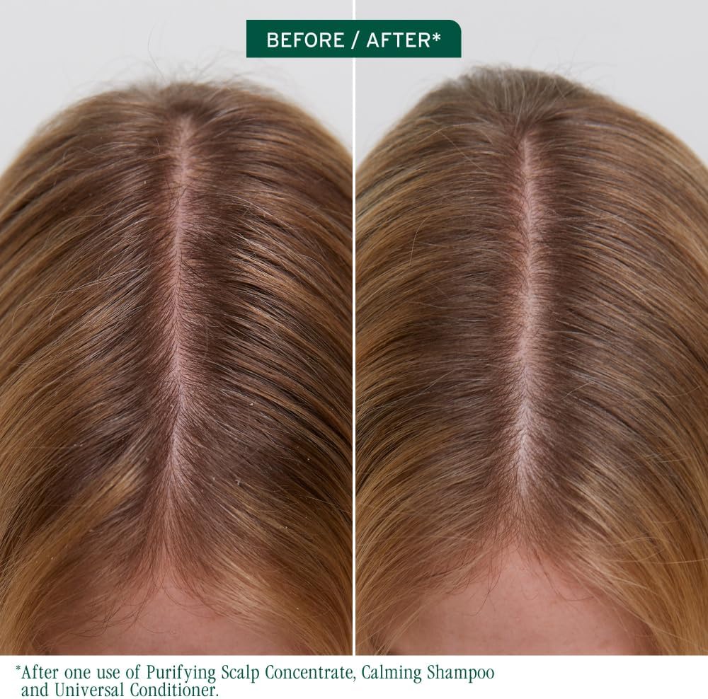 Detalle 2 de Biolage Scalp Sync Purifying Scalp Concentrate (Glycolic Acid), 200ml